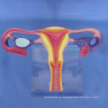 De alta calidad de enseñanza médica Uterus modelo anatómico (R110217)